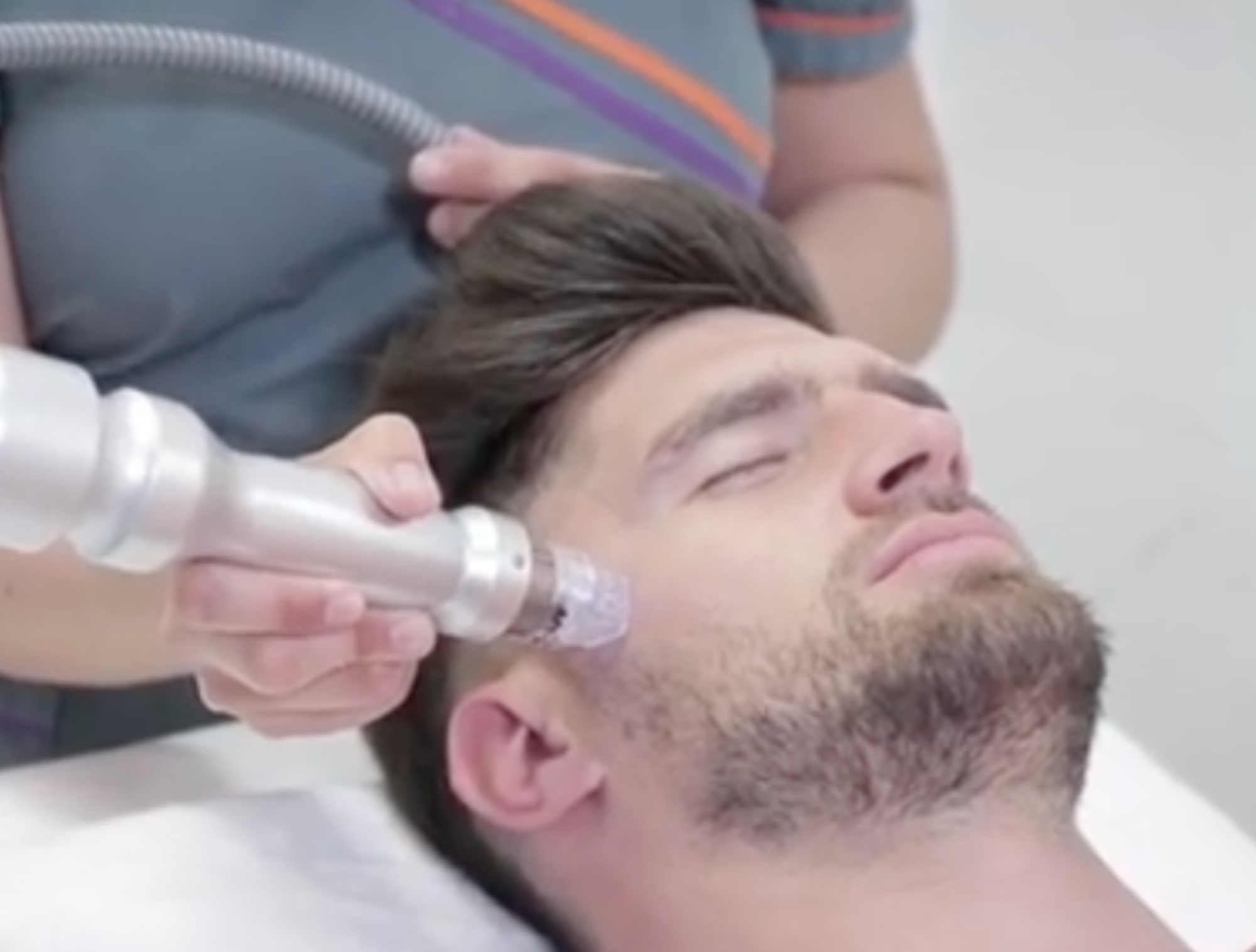 Radiofrecuencia Fraccionada - Textura y firmeza renovadas en tu rostro.