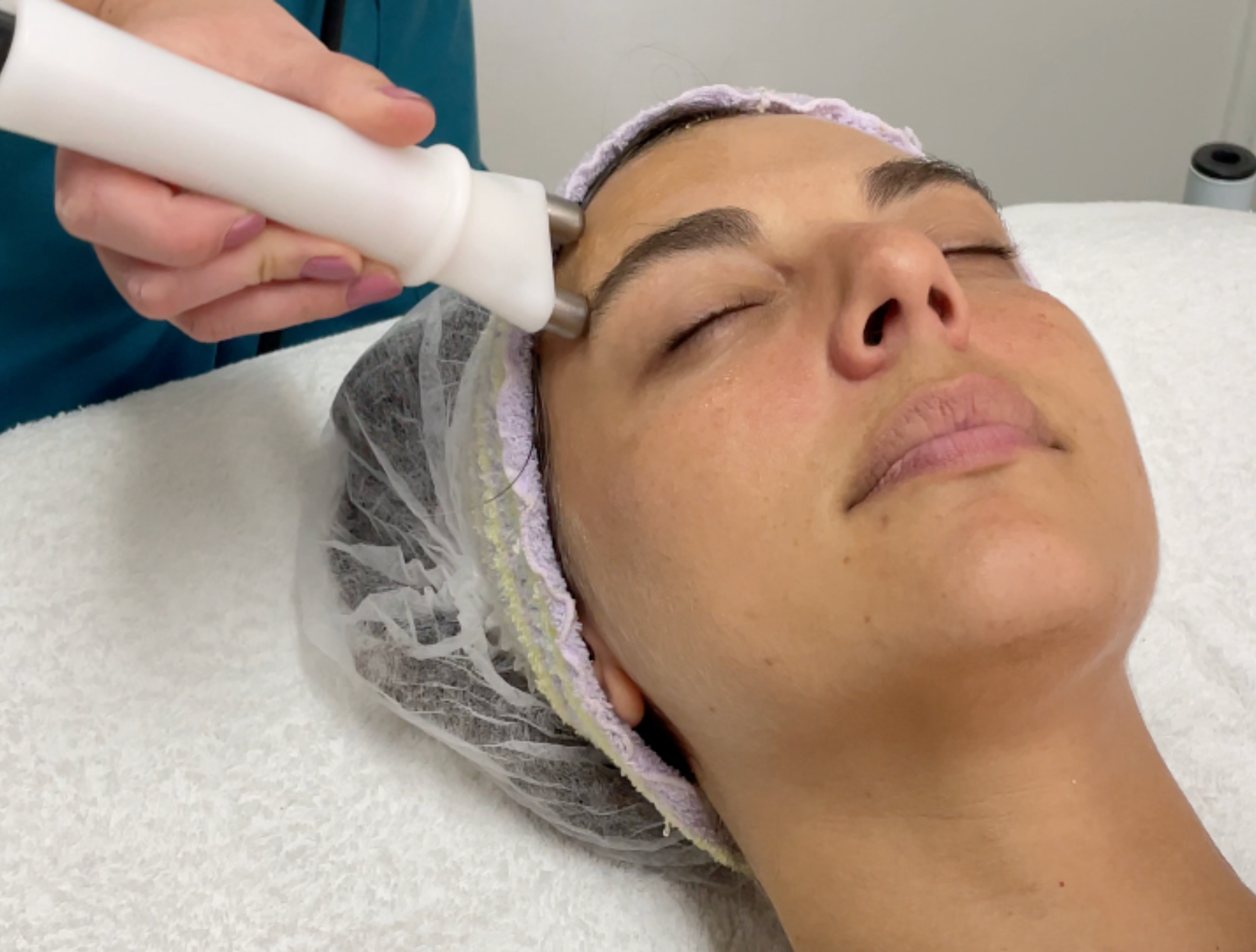 2 sesiones  Pack Rejuvenecimiento Total